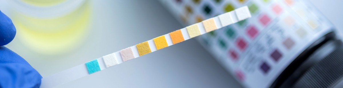 Episode 28: Why does a UTI&nbsp;“burn”?