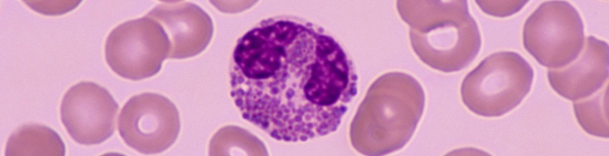 Episode 32: Why do eosinophils vanish from the blood after treatment with corticosteroids?