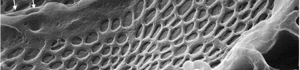 Episode 48 – Urine the&nbsp;Lung