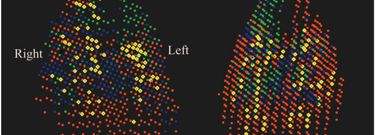 Episode 53 – Very/Qurious&nbsp;Hypoxemia