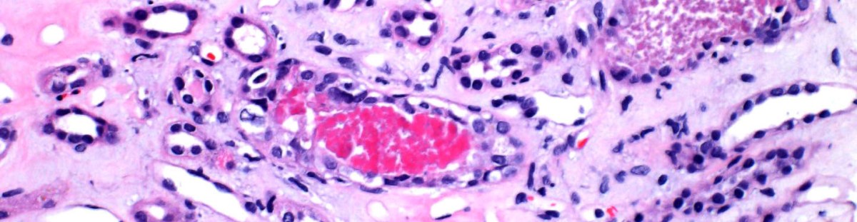 Episode 55 – A Cute&nbsp;Pigment