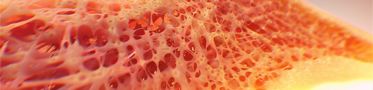 Episode 57 – The Acetabular&nbsp;Ache