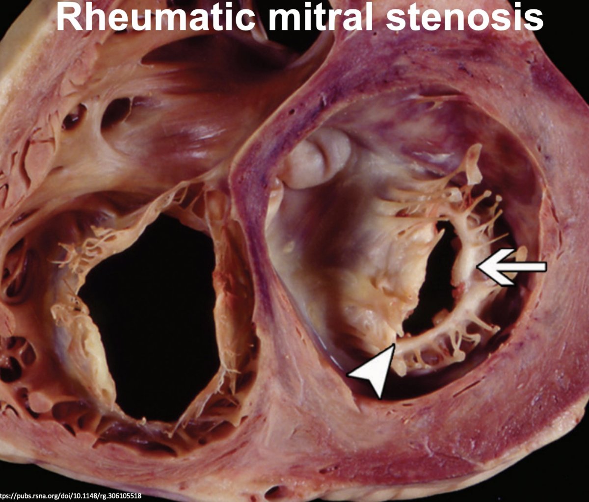 Episode 65 – Taking Things to&nbsp;Heart