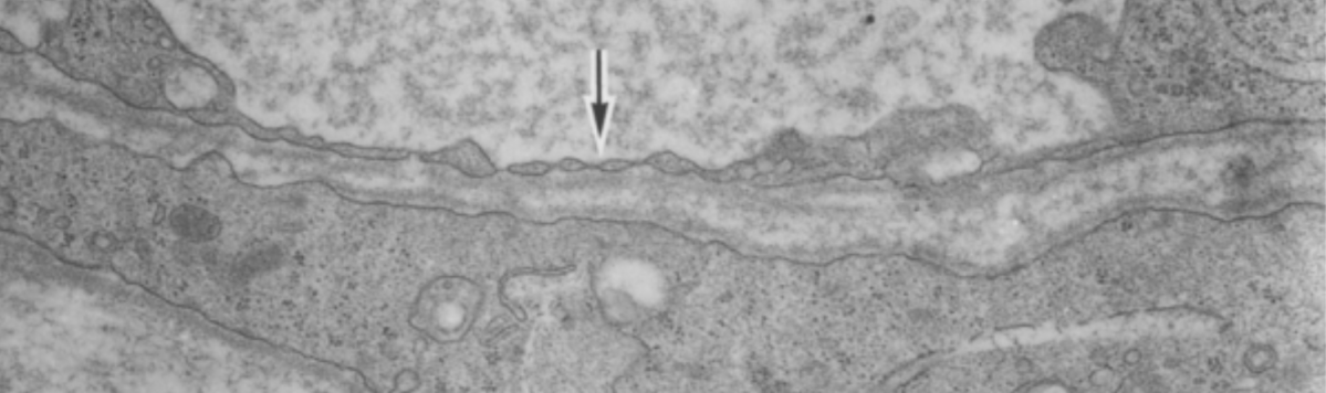 Episode 67 – Crossing a&nbsp;Barrier