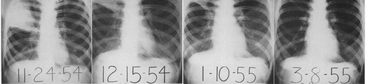 Episode 71 – Slow to&nbsp;Resolve