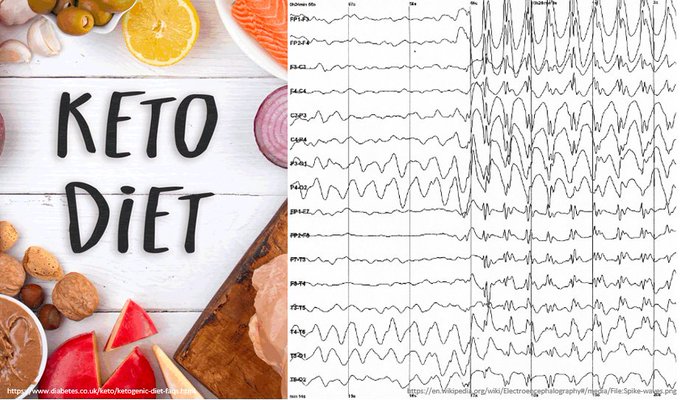 Episode 79 – Kurious&nbsp;Keto