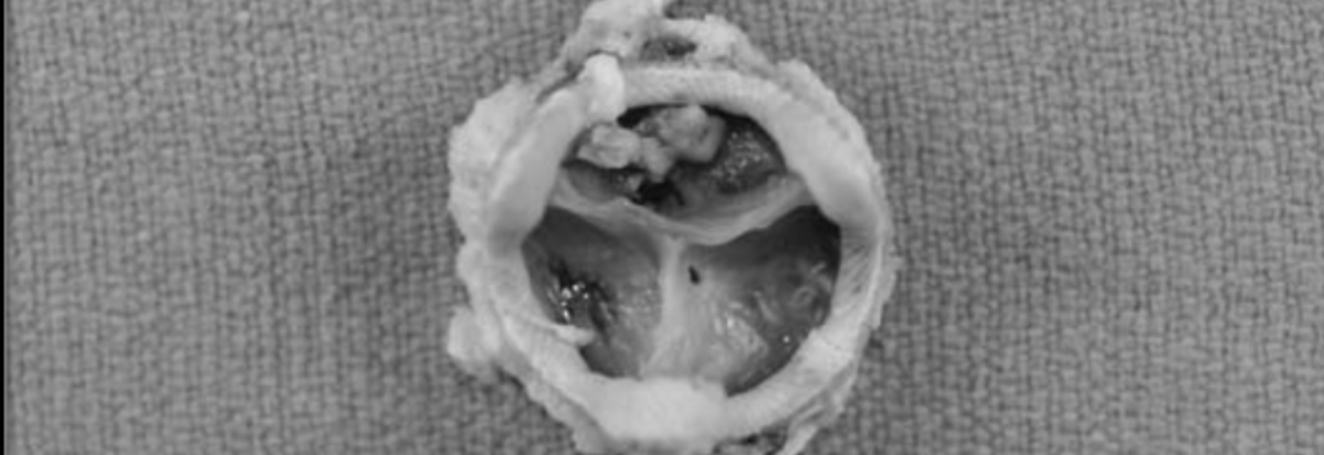 Episode 78 – Valve&nbsp;Privilege