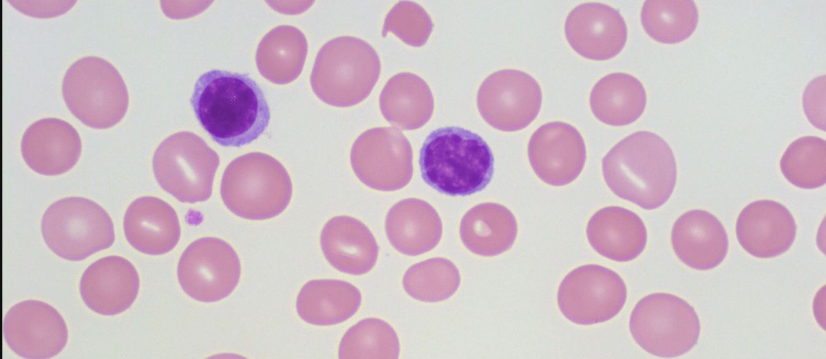 Episode 86 – Enlarging&nbsp;Alcohol