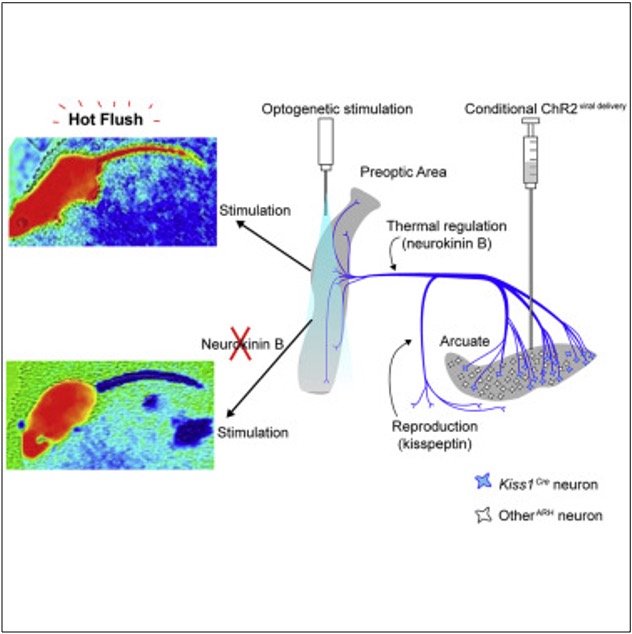 Neural Flash Episode 94 – Flash in the PA – The Curious Clinicians