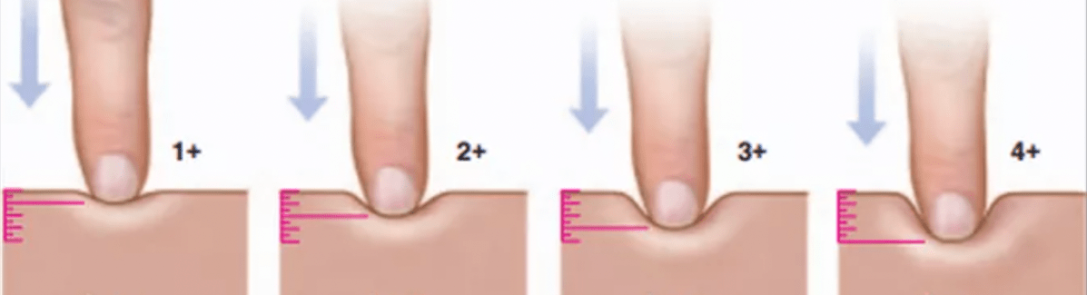 Episode 97 – Cascading&nbsp;Prescriptions