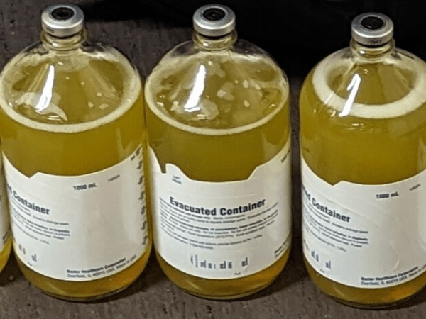 Episode 119 – While My Liver Gently&nbsp;Weeps