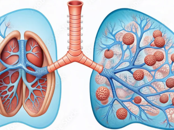 Episode 124- One of the Fastest Reactions in the Human&nbsp;Body