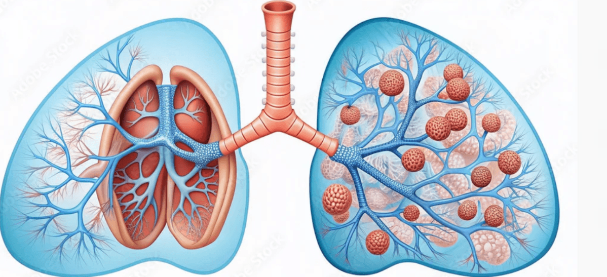 Episode 124- One of the Fastest Reactions in the Human&nbsp;Body